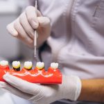 Импланты зубов в Красноярске: современное решение для красивой и здоровой улыбки