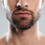 Пересадка усов: современный подход к формированию мужского образа